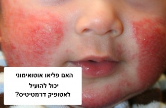 האם שינוי תזונתי יכול להועיל לאטופיק דרמטיטיס?